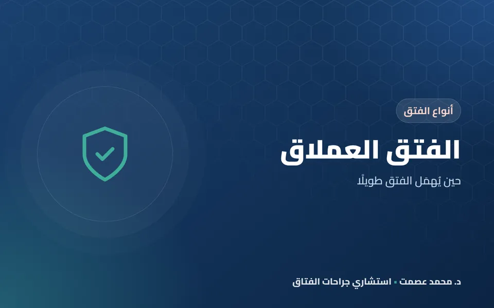 الفتق العملاق
