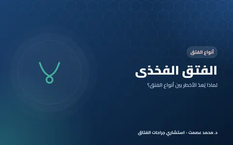 الفتق الفخذي لماذا يُعدّ الأخطر بين أنواع الفتق؟