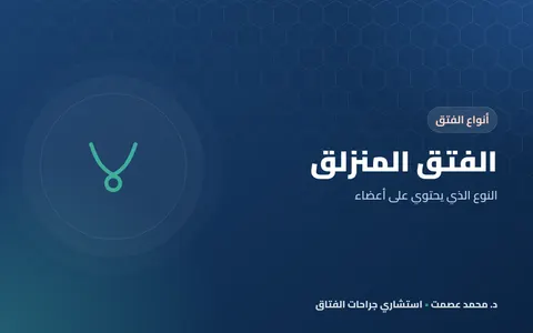 الفتق المنزلق النوع الذي يحتوي على أعضاء