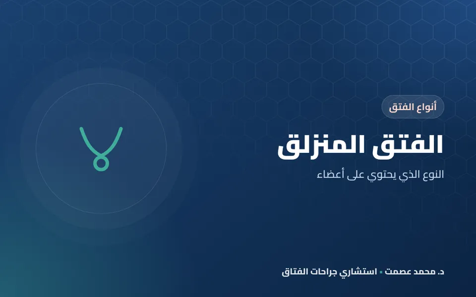 الفتق المنزلق النوع الذي يحتوي على أعضاء