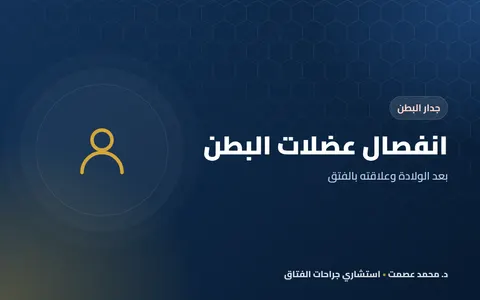 انفصال عضلات البطن بعد الولادة وعلاقته بالفتق
