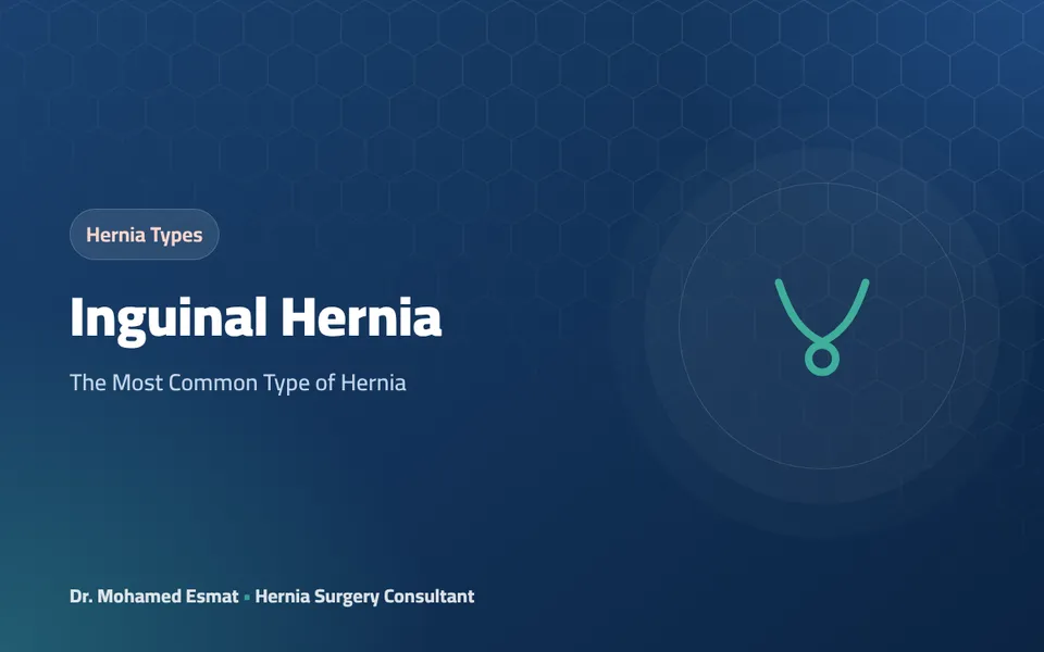 Inguinal Hernia: The Most Common Type of Hernia