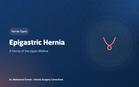 Epigastric Hernia: A Hernia of the Upper Midline