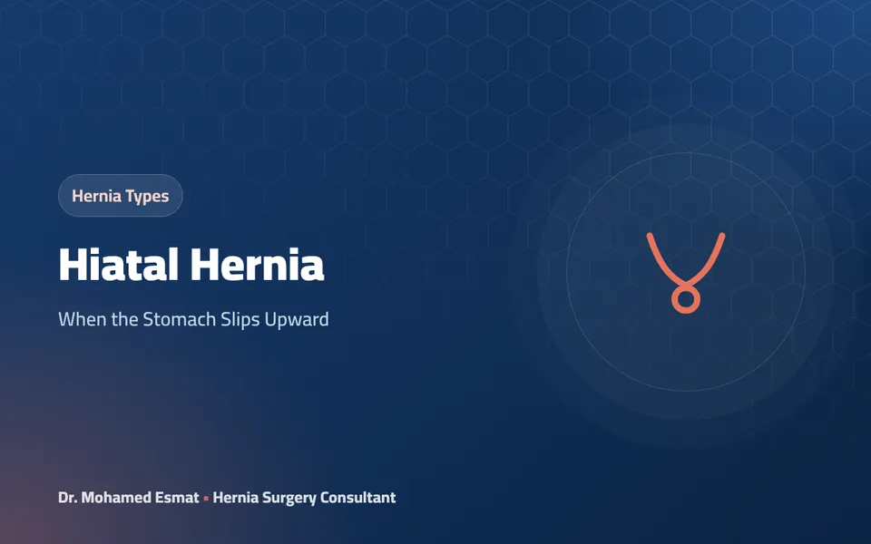 Hiatal Hernia: When the Stomach Slips Upward