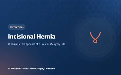 Incisional Hernia: When a Hernia Appears at a Previous Surgery Site