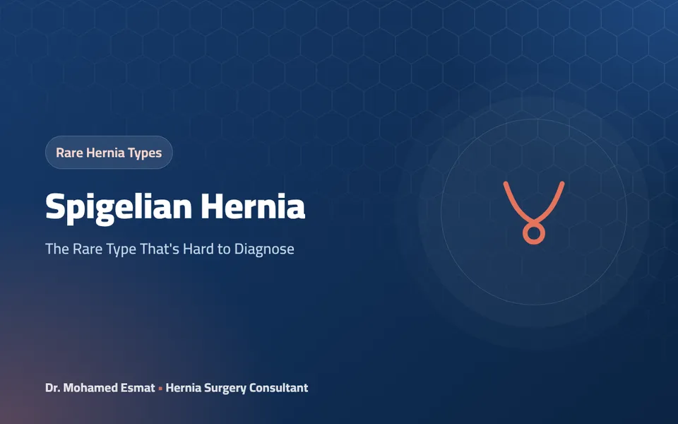 Spigelian Hernia: The Rare Type That's Hard to Diagnose