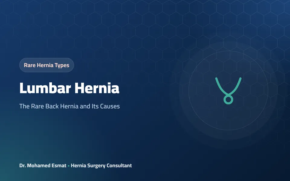 Lumbar Hernia: The Rare Back Hernia and Its Causes
