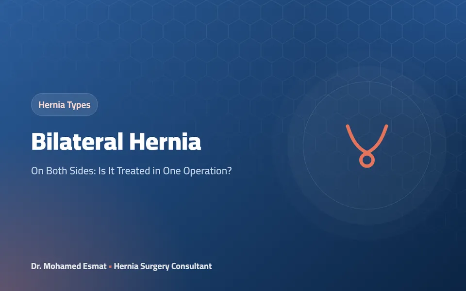 Bilateral Hernia: On Both Sides: Is It Treated in One Operation?