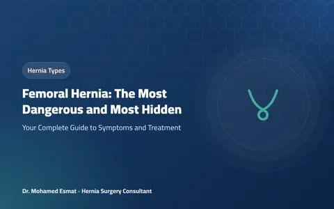 Femoral Hernia: The Most Dangerous and Most Hidden