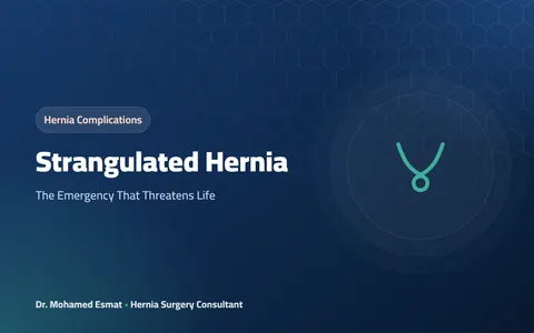 Strangulated Hernia: The Emergency That Threatens Life