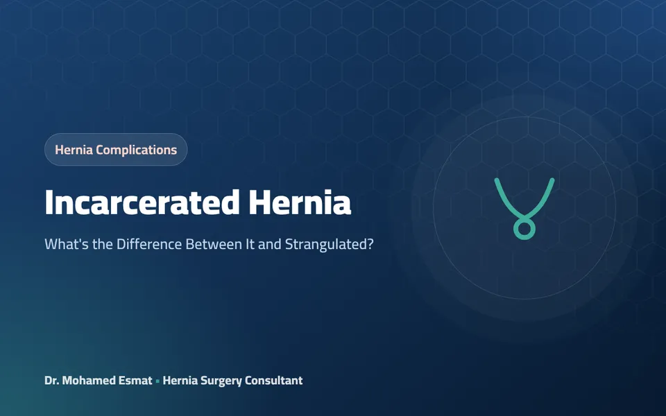 Incarcerated Hernia: What's the Difference Between It and Strangulated?