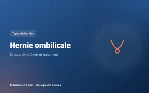 Hernie ombilicale : causes, symptômes et traitement