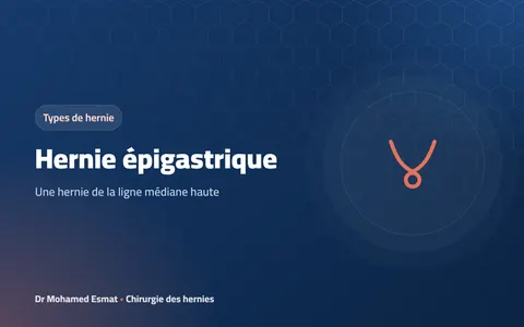Hernie épigastrique : une hernie de la ligne médiane haute