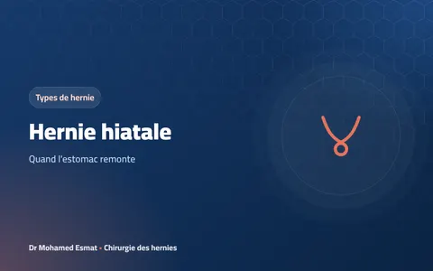 Hernie hiatale : quand l'estomac remonte