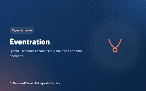 Éventration : quand une hernie apparaît sur une ancienne cicatrice