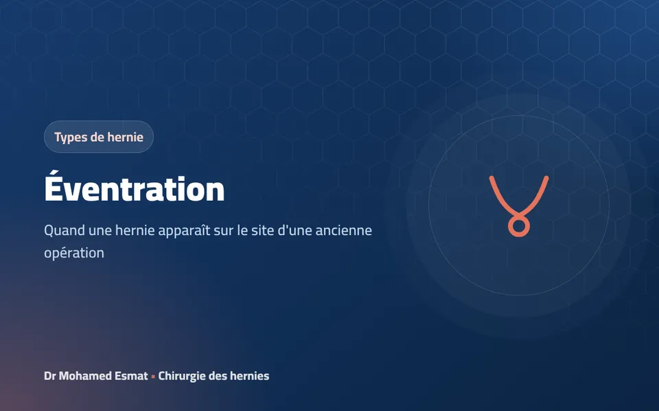 Éventration : quand une hernie apparaît sur une ancienne cicatrice