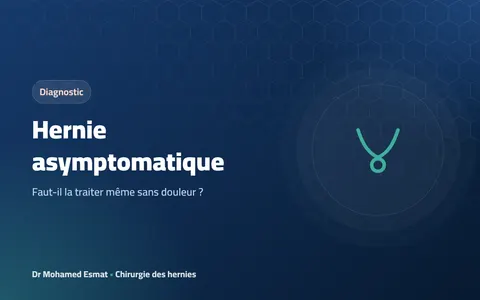 Hernie asymptomatique : faut-il la traiter même sans douleur ?