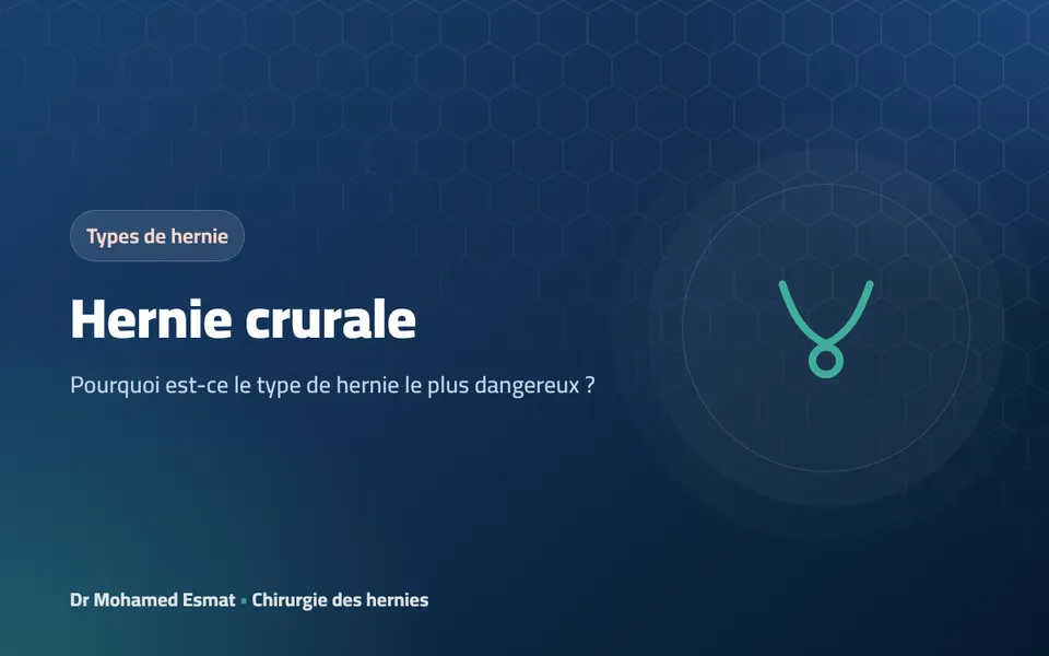 Hernie crurale : pourquoi est-ce le type de hernie le plus dangereux ?