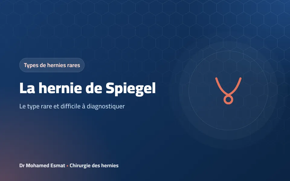 Hernie de Spiegel : le type rare et difficile à diagnostiquer