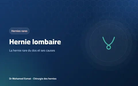 Hernie lombaire : la hernie rare du dos et ses causes