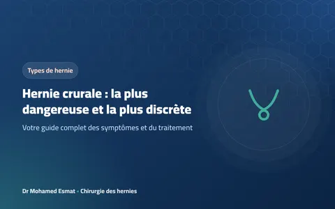 Hernie crurale : la plus dangereuse et la plus discrète