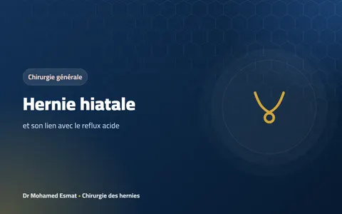 Hernie hiatale et reflux acide