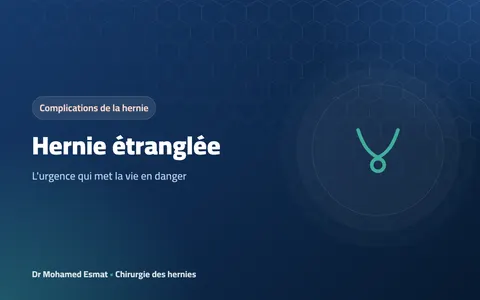 Hernie étranglée : l'urgence qui met la vie en danger
