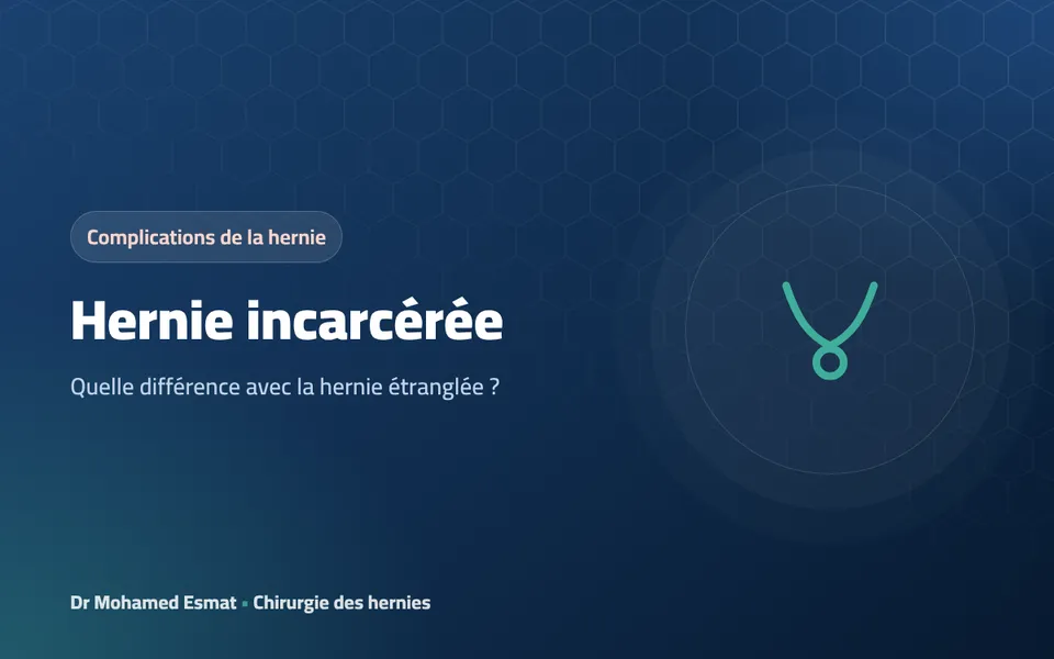 Hernie incarcérée : quelle différence avec la hernie étranglée ?