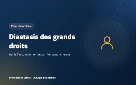 Diastasis des grands droits