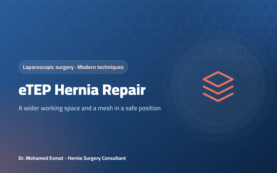 eTEP Laparoscopic Hernia Repair: What Is New About It?