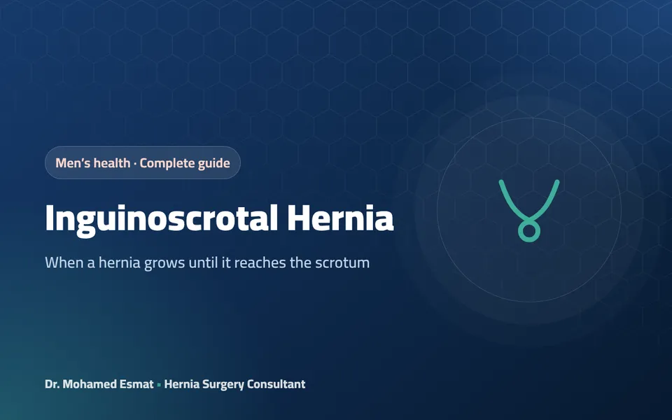 Inguinoscrotal Hernia: When an Inguinal Hernia Reaches the Scrotum