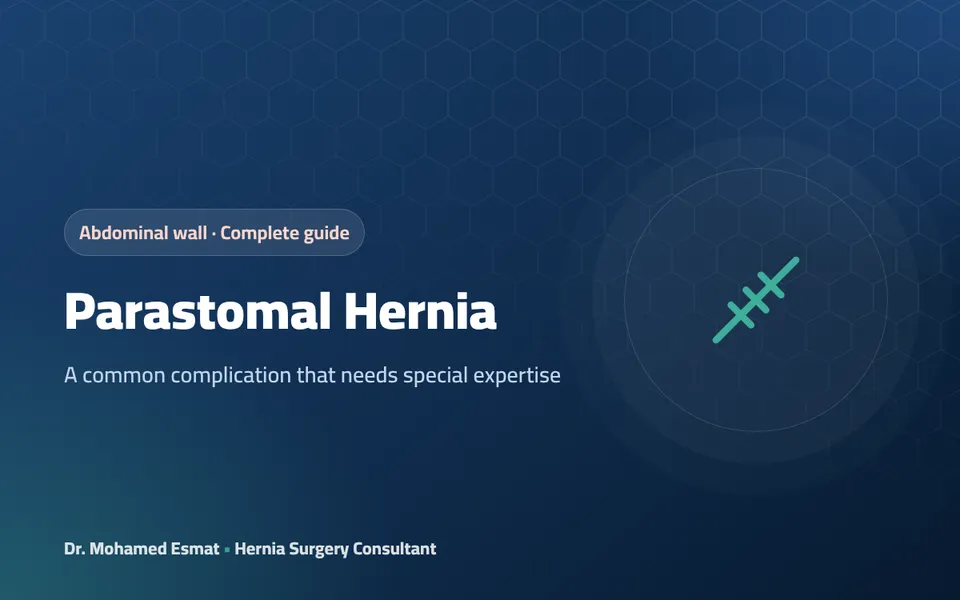 Parastomal Hernia: A Hernia Around a Colostomy or Ileostomy