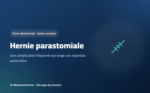 Hernie parastomiale : la hernie autour d’une colostomie ou d’une iléostomie