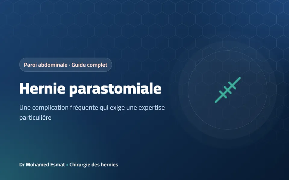 Hernie parastomiale : la hernie autour d’une colostomie ou d’une iléostomie