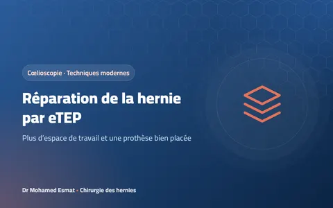 Technique eTEP de réparation de la hernie par cœlioscopie : quoi de neuf ?