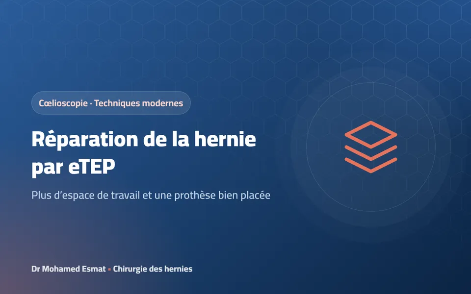 Technique eTEP de réparation de la hernie par cœlioscopie : quoi de neuf ?
