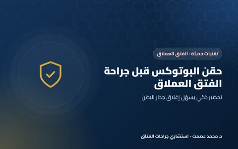 حقن البوتوكس قبل جراحة الفتق العملاق: كيف تساعد في إغلاق الجدار؟